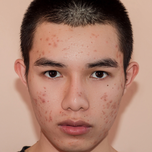 Before